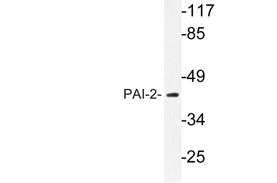 Western Blot - Anti-PAI-2 Antibody (R12-2289) - Antibodies.com