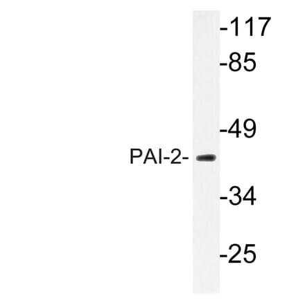 Western Blot - Anti-PAI-2 Antibody (R12-2289) - Antibodies.com