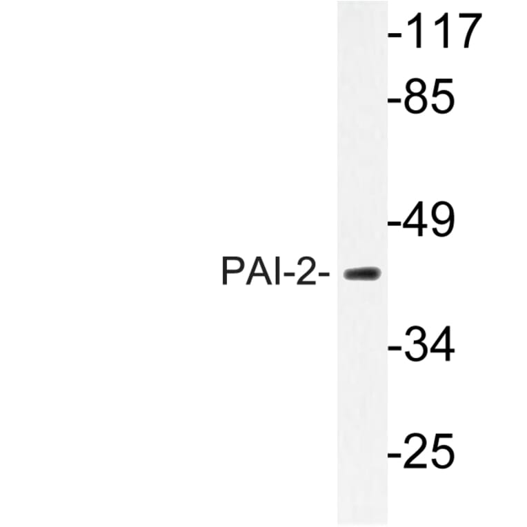 Western Blot - Anti-PAI-2 Antibody (R12-2289) - Antibodies.com