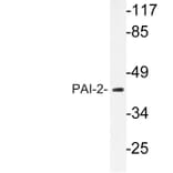 Western Blot - Anti-PAI-2 Antibody (R12-2289) - Antibodies.com