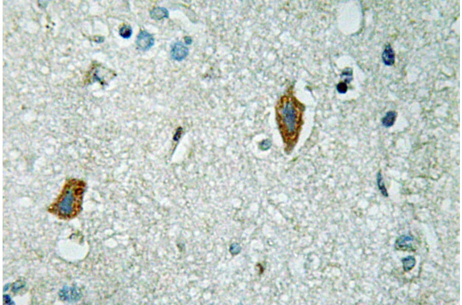 Immunohistochemistry - Anti-PAI-2 Antibody (R12-2289) - Antibodies.com