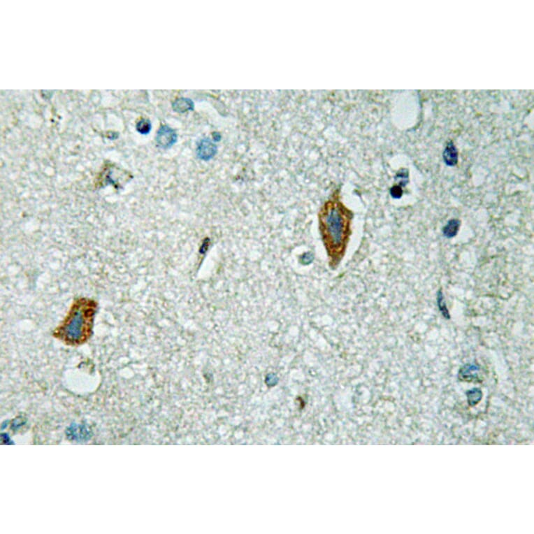 Immunohistochemistry - Anti-PAI-2 Antibody (R12-2289) - Antibodies.com