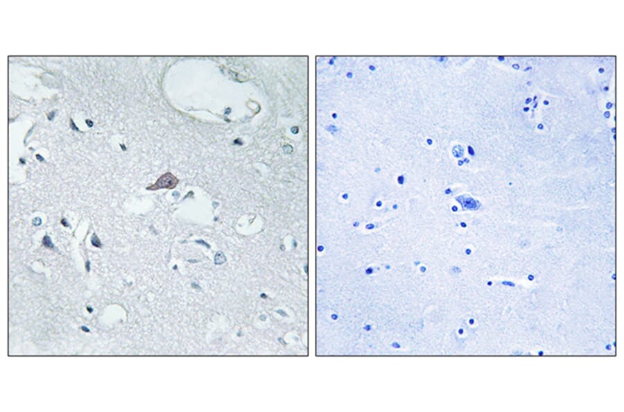 Immunohistochemistry - Anti-OPRM1 Antibody (G492) - Antibodies.com