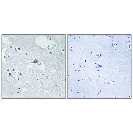Immunohistochemistry - Anti-OPRM1 Antibody (G492) - Antibodies.com