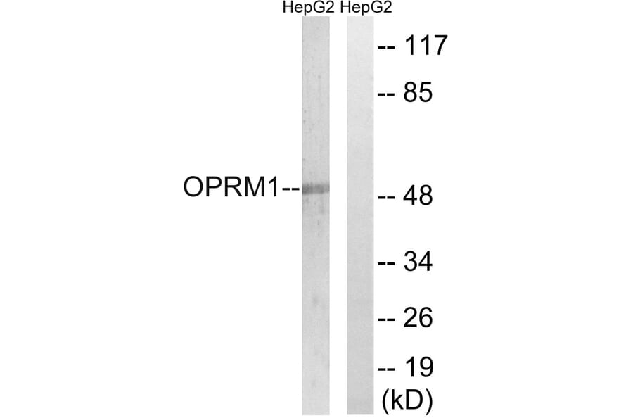 Western Blot - Anti-OPRM1 Antibody (G492) - Antibodies.com