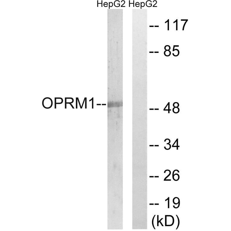 Western Blot - Anti-OPRM1 Antibody (G492) - Antibodies.com
