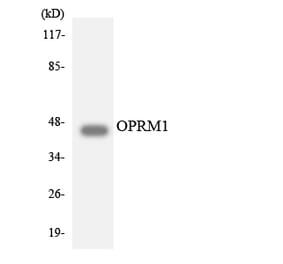 Western Blot - Anti-OPRM1 Antibody (R12-3124) - Antibodies.com