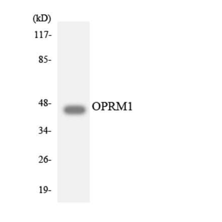 Western Blot - Anti-OPRM1 Antibody (R12-3124) - Antibodies.com