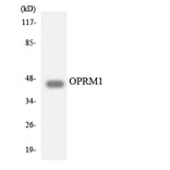 Western Blot - Anti-OPRM1 Antibody (R12-3124) - Antibodies.com
