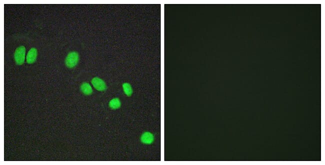Immunofluorescence analysis of A549 cells using Anti-NCOR2 Antibody. The right hand panel represents a negative control, where the antibody was pre-incubated with the immunising peptide.