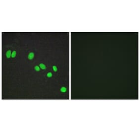 Immunofluorescence - Anti-NCOR2 Antibody (C11981) - Antibodies.com