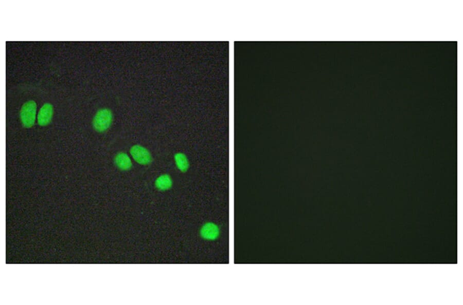 Immunofluorescence - Anti-NCOR2 Antibody (C11981) - Antibodies.com