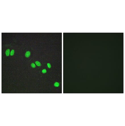 Immunofluorescence - Anti-NCOR2 Antibody (C11981) - Antibodies.com