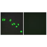 Immunofluorescence - Anti-NCOR2 Antibody (C11981) - Antibodies.com