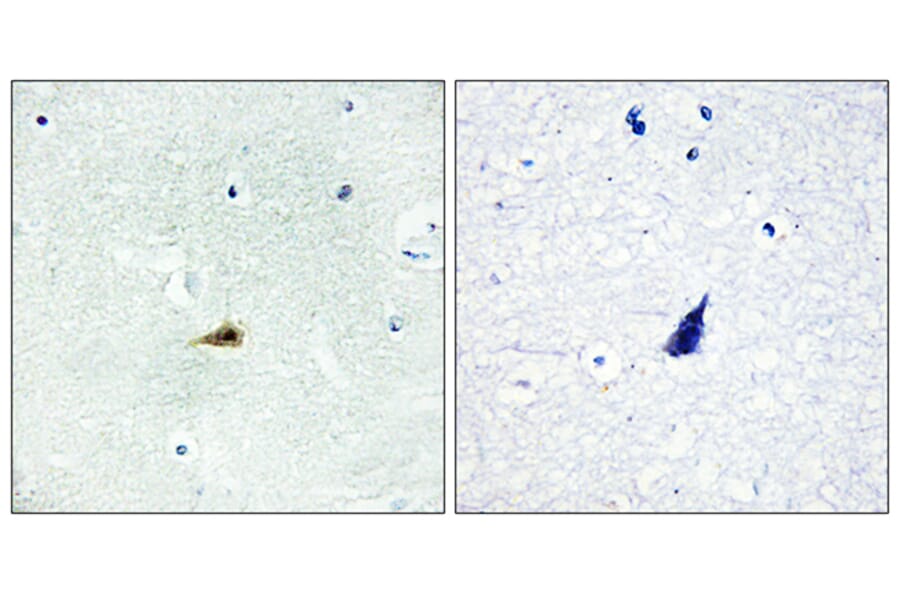 Immunohistochemistry - Anti-NCOR2 Antibody (C11981) - Antibodies.com