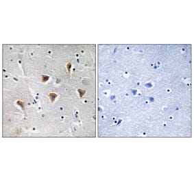 Immunohistochemistry - Anti-MTERF Antibody (C19238) - Antibodies.com