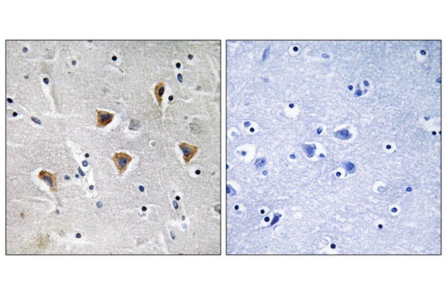 Immunohistochemistry - Anti-MTERF Antibody (C19238) - Antibodies.com