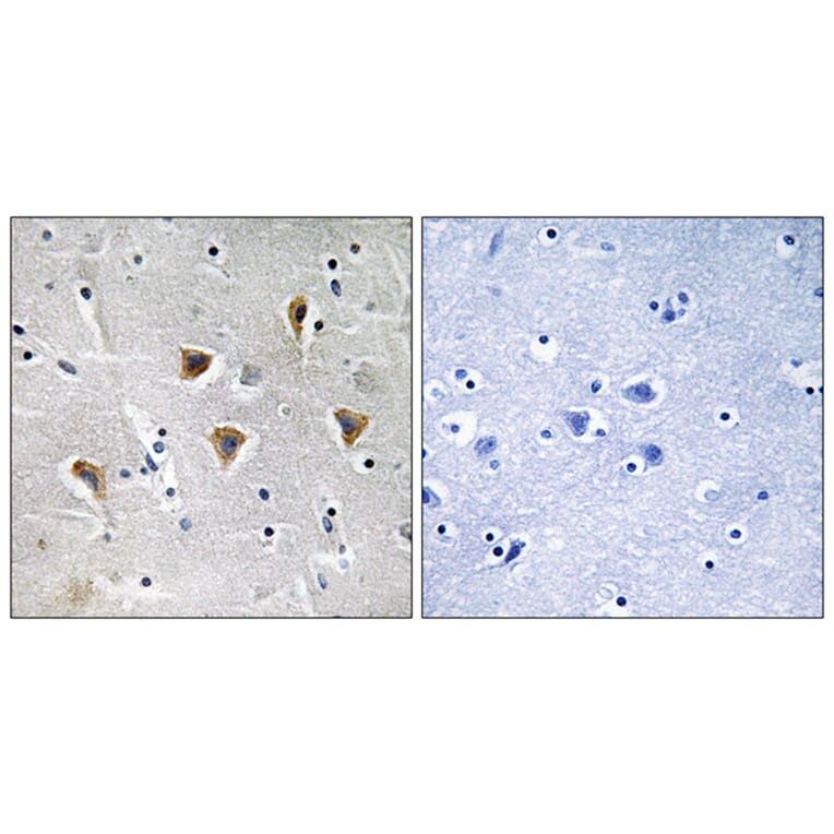Immunohistochemistry - Anti-MTERF Antibody (C19238) - Antibodies.com
