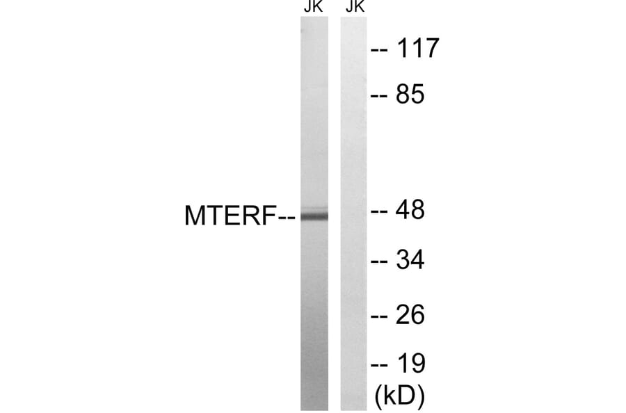 Western Blot - Anti-MTERF Antibody (C19238) - Antibodies.com