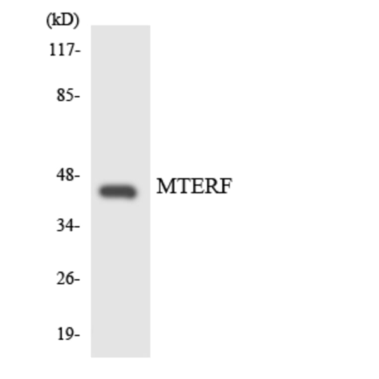 Western Blot - Anti-MTERF Antibody (R12-3060) - Antibodies.com