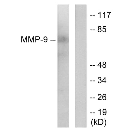 Western Blot - Anti-MMP-9 Antibody (C0275) - Antibodies.com