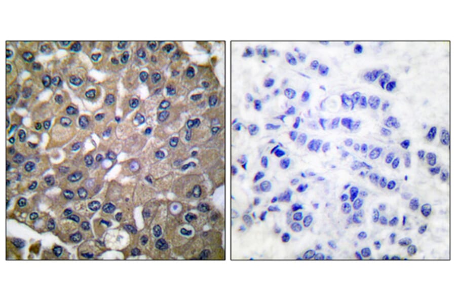 Immunohistochemistry - Anti-MMP-9 Antibody (C0275) - Antibodies.com
