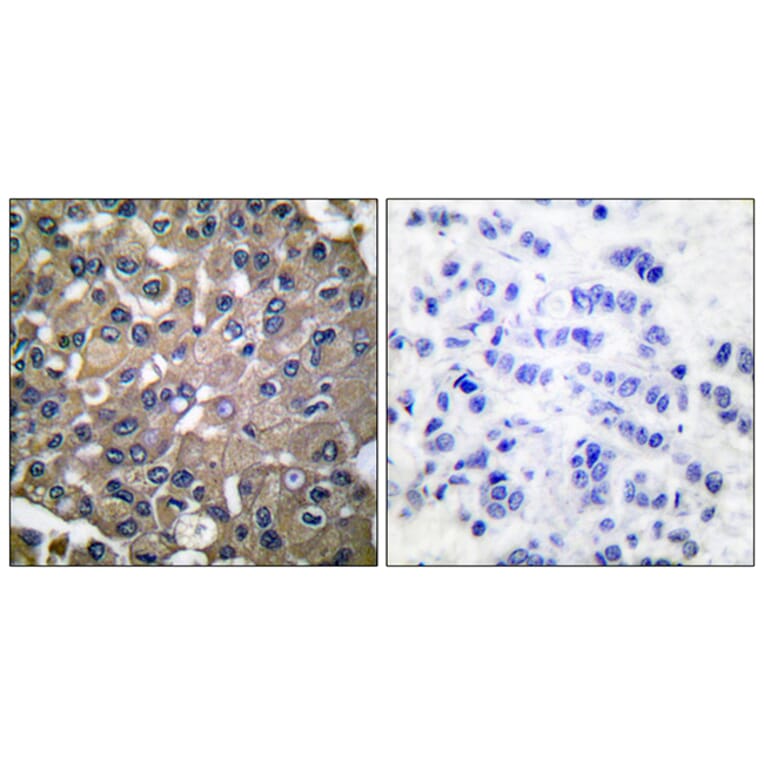 Immunohistochemistry - Anti-MMP-9 Antibody (C0275) - Antibodies.com
