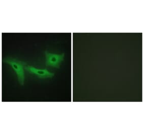 Immunofluorescence - Anti-LRRK1 Antibody (C11153) - Antibodies.com