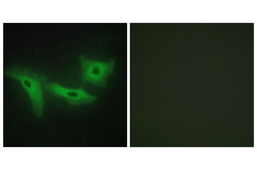 Immunofluorescence - Anti-LRRK1 Antibody (C11153) - Antibodies.com