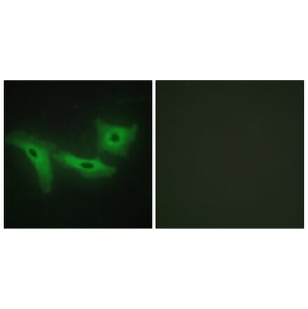 Immunofluorescence - Anti-LRRK1 Antibody (C11153) - Antibodies.com