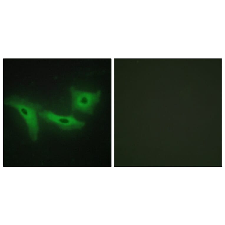 Immunofluorescence - Anti-LRRK1 Antibody (C11153) - Antibodies.com