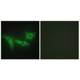 Immunofluorescence - Anti-LRRK1 Antibody (C11153) - Antibodies.com