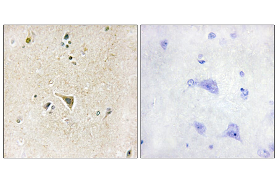 Immunohistochemistry - Anti-LRRK1 Antibody (C11153) - Antibodies.com