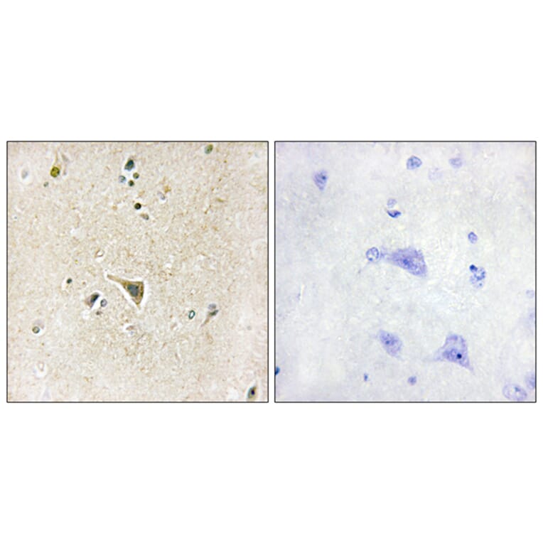 Immunohistochemistry - Anti-LRRK1 Antibody (C11153) - Antibodies.com