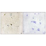 Immunohistochemistry - Anti-LRRK1 Antibody (C11153) - Antibodies.com