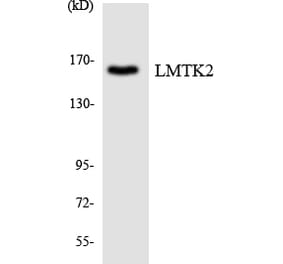 Western Blot - Anti-LMTK2 Antibody (R12-2973) - Antibodies.com