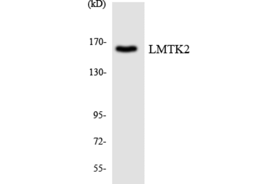 Western Blot - Anti-LMTK2 Antibody (R12-2973) - Antibodies.com