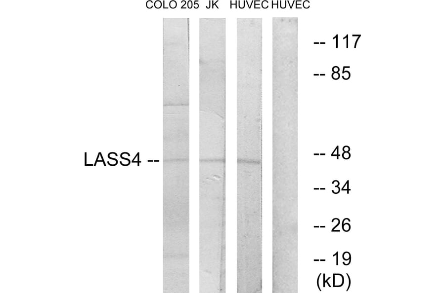 Western Blot - Anti-LASS4 Antibody (C11714) - Antibodies.com