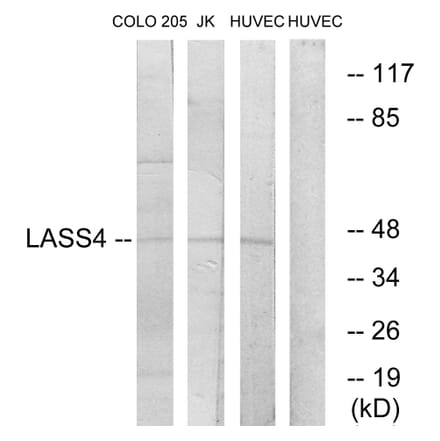 Western Blot - Anti-LASS4 Antibody (C11714) - Antibodies.com