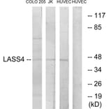 Western Blot - Anti-LASS4 Antibody (C11714) - Antibodies.com