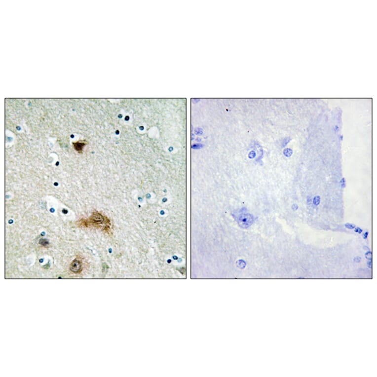 Immunohistochemistry - Anti-LASS4 Antibody (C11714) - Antibodies.com