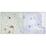 Immunohistochemistry - Anti-LASS4 Antibody (C11714) - Antibodies.com