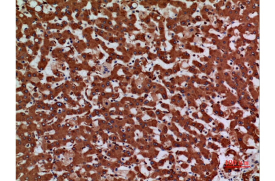 Immunohistochemistry - Anti-LAMC2 Antibody (C30224) - Antibodies.com