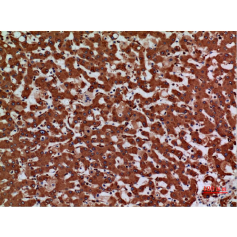 Immunohistochemistry - Anti-LAMC2 Antibody (C30224) - Antibodies.com