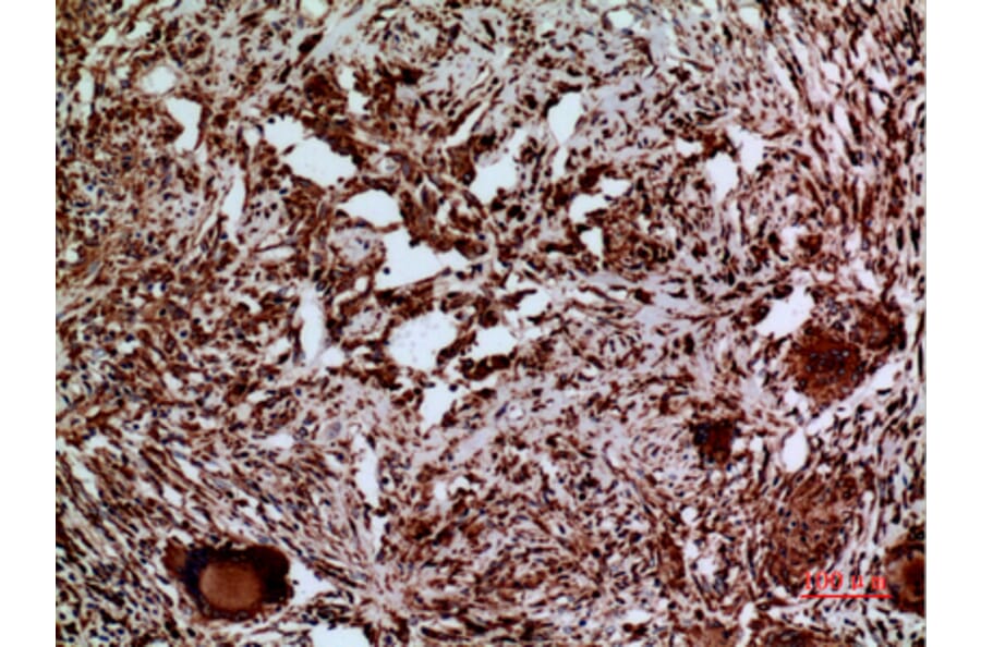 Immunohistochemistry - Anti-LAMC2 Antibody (C30224) - Antibodies.com