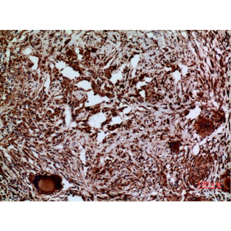 Immunohistochemistry - Anti-LAMC2 Antibody (C30224) - Antibodies.com