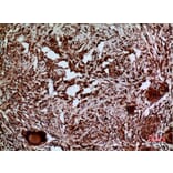 Immunohistochemistry - Anti-LAMC2 Antibody (C30224) - Antibodies.com