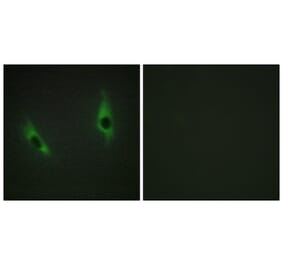 Immunofluorescence - Anti-LAMB3 Antibody (C13071) - Antibodies.com