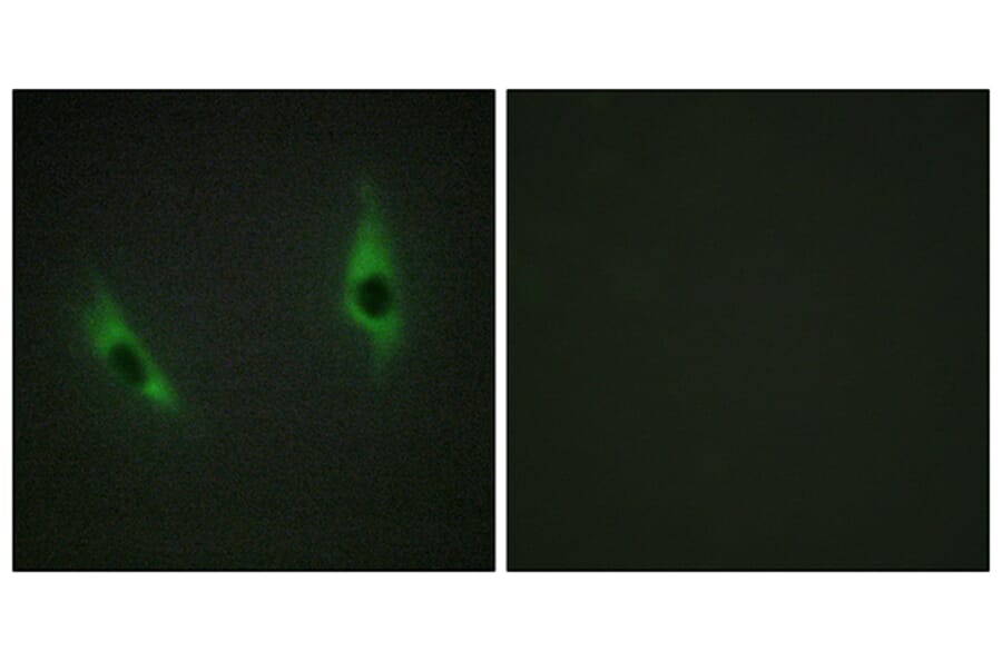 Immunofluorescence - Anti-LAMB3 Antibody (C13071) - Antibodies.com