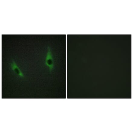 Immunofluorescence - Anti-LAMB3 Antibody (C13071) - Antibodies.com